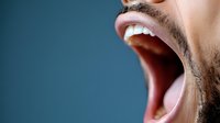 Close-up macro shot of male mouth with beard stubble showing wide open expression against dark blue background, displaying dental and oral features.