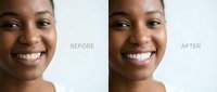 Young African American woman showing teeth whitening transformation with bright smile before and after dental treatment results for cosmetic dentistry.