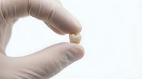 Scientist in medical gloves holding small bone sample or specimen for laboratory research, healthcare, and educational purposes.