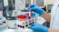 Laboratory technician in blue gloves handling blood sample tubes in medical testing facility for diagnostic analysis and healthcare research.