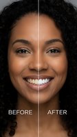 Young African American woman showing teeth whitening transformation with bright smile before and after comparison for dental care advertising.