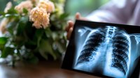 Medical x-ray scan of human chest and lungs displayed on digital tablet screen, with soft-focused carnation flowers in background creating healthcare ambiance.