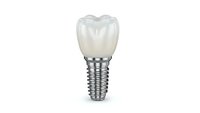 Dental implant with crown isolated on white background for medical and healthcare design projects.