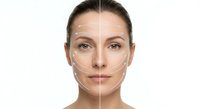 Young woman face with cosmetic surgery markings showing before and after skin treatment results on white background for beauty procedures.
