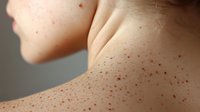 Close up view of skin with scattered freckles and natural beauty marks on shoulder area against neutral background, showing texture and natural skin patterns.