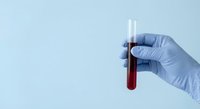 Medical professional in blue latex gloves holding blood sample test tube for laboratory analysis and diagnostic testing in healthcare setting.