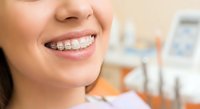 Young woman with metal braces smiling in dental office showing orthodontic treatment progress during routine checkup appointment.