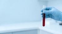 Medical professional holding blood sample test tube in laboratory for diagnostic analysis and healthcare research.