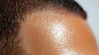 Close up view of African American person's forehead showing oily, shiny skin texture with visible pores and natural skin imperfections in warm lighting.