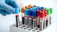 Medical professional in blue gloves handling blood sample tubes in laboratory rack for diagnostic testing and healthcare analysis.