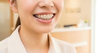 Young Asian woman with metal braces smiling showing orthodontic treatment in dental office for teeth straightening and oral health care.