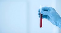 Medical professional hand in blue latex glove holding blood sample test tube for laboratory analysis and diagnostic testing in clinical setting.