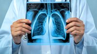 Medical professional holding chest x-ray film showing detailed lung scan with visible bronchi and pulmonary vessels against bright background. For healthcare and medical concepts.