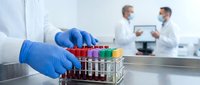 Laboratory technician wearing blue gloves holding test tubes with blood samples while colleagues discuss results in clinical setting.