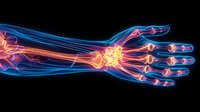 X-ray visualization of human hand and wrist with highlighted joint inflammation points, perfect for medical education, rheumatology presentations, and healthcare materials.