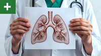 Medical professional in white coat holding anatomical illustration of human lungs with detailed bronchial tree structure and airways shown in red against white background.