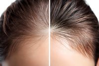Close-up view of scalp showing hair parting line with visible hair growth pattern and texture, demonstrating before and after hair treatment comparison.
