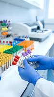 Laboratory technician in blue gloves holding blood test tubes with colorful sample rack and microscope in modern medical lab for diagnostic testing.