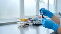 Medical laboratory technician in blue gloves holding blood sample test tube for analysis with colorful specimen tubes in background for healthcare research.
