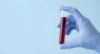 Medical professional in protective gloves holding blood sample test tube for laboratory analysis and diagnostic testing procedures.