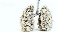 Human lungs made of money cash dollars, healthcare cost concept, medical insurance and financial burden of treatment isolated on white.
