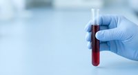 Medical professional in blue latex gloves holding test tube with red blood sample in sterile laboratory environment for diagnostic testing and analysis.