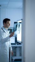 Male doctor examining chest x-ray on lightbox in modern hospital room. Medical professional analyzing lung radiograph for diagnosis and treatment planning.