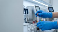 Laboratory technician in blue gloves handling test tubes with blood samples in modern medical research facility for diagnostic testing and analysis.