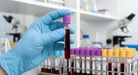Medical laboratory technician in blue gloves holding blood sample tube for testing and analysis in clinical research facility with microscope equipment.