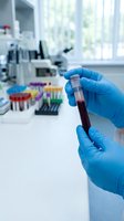 Medical laboratory technician hands in blue gloves holding blood sample test tube in modern clinical research facility for diagnostic testing and analysis.