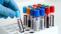 Medical laboratory technician in blue gloves handling blood sample vials with colorful caps for diagnostic testing and healthcare analysis.