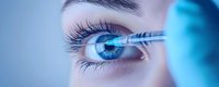 Close up view of bright blue eye with long eyelashes and eyebrow against blue background, medical procedure with tweezers near eye area for cosmetic treatment.