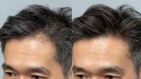 Close-up comparison of male hair showing gray coverage treatment, highlighting before and after results for men's grooming and anti-aging solutions.