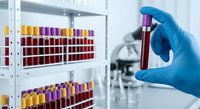 Medical laboratory technician in blue gloves holding blood sample test tube with organized specimen rack in clinical research facility background.