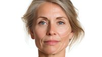 Mature Caucasian woman with blonde hair showing facial aging process with treatment lines marked on half of face, demonstrating cosmetic procedure planning.