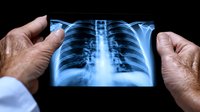 Medical professional holding chest x-ray film showing human ribcage and spine, illuminated against dark background for diagnostic examination and healthcare concept.