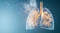 Glowing translucent human lungs with bronchial tree structure dissolving into particles against blue background, medical science visualization concept.