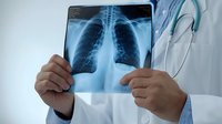 Medical professional examining chest x-ray scan showing lungs and ribcage, wearing white coat with stethoscope. Healthcare diagnostics in modern hospital setting.
