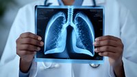 Medical professional holding chest x-ray showing detailed view of human lungs and respiratory system, blue tinted radiograph scan for healthcare diagnostics.