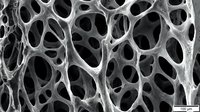 Microscopic view of porous foam structure with interconnected cellular cavities and white striated walls, suitable for scientific, medical, and material research applications.
