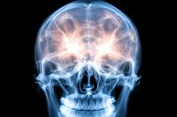 X-ray scan of human skull showing detailed bone structure and teeth in blue and pink glowing colors against black background, medical visualization.