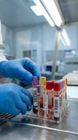Medical laboratory technician in blue gloves handling blood sample tubes in sterile clinical environment for diagnostic testing and analysis.