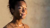Young African American woman with vitiligo skin condition in natural sunlight showing confidence and self-acceptance in warm golden hour lighting.