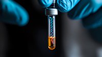 Medical researcher in blue protective gloves holding test tube with orange liquid and DNA helix structure against dark background, scientific laboratory research concept.