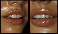 Close up of smiling lips showing healthy white teeth, glowing skin and natural glossy lip texture. Comparison of two different skin tones demonstrating dental aesthetics.
