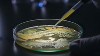 Laboratory petri dish with bacterial culture and pipette for microbiological research and scientific analysis in medical testing environment.