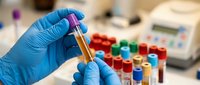 Laboratory technician in blue gloves holding test tube with yellow liquid sample. Medical research and analysis equipment with colorful specimens in background.