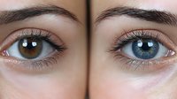Close-up comparison of two different colored eyes showing heterochromia, one brown and one blue, with detailed view of iris patterns and eyelashes.