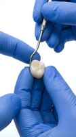 Dentist in blue gloves examining extracted molar tooth with dental probe on white background, showcasing oral health and dental care.