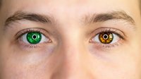 Close-up of human eyes showing heterochromia with one green eye and one brown eye, genetic condition creating unique dual-colored vision appearance.